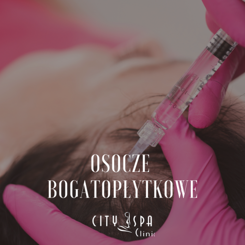 Mezoterapia osoczem bogatopłytkowym